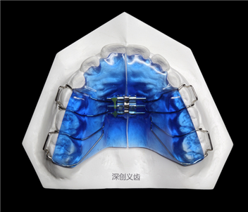C-002 两面螺丝扩弓器